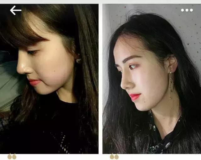 日本瘦脸神器pro真的有用吗,瘦脸神器测评有效的美容仪