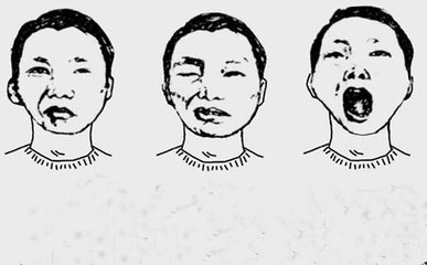 天气冷面瘫是怎么回事,天气寒冷导致的面瘫