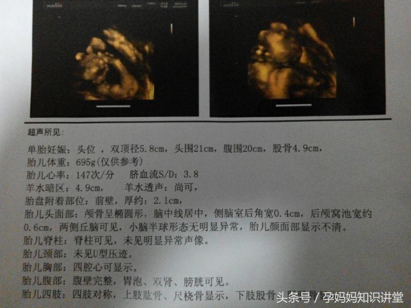 拍四维彩超让注意左肾情况,做四维彩超需要注意什么