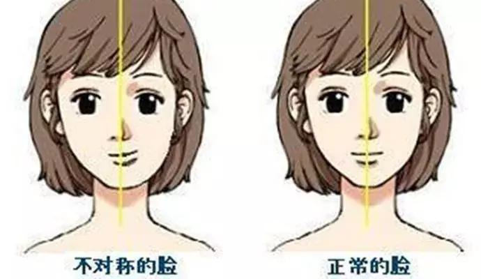 脸歪大小脸严重怎么办,脸歪大小眼可以完全矫正吗