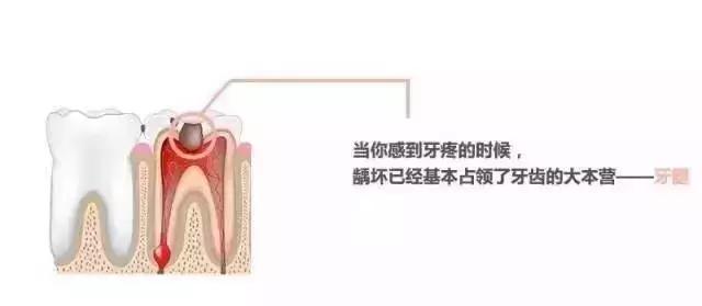 同样是补牙价格为什么差很远,同样补牙为什么报销不一样