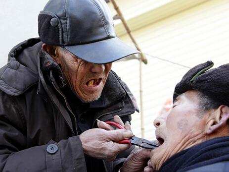 困扰20年的拔牙恐惧,如何克服对拔牙的恐惧感