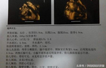 拍四维彩超让注意左肾情况,做四维彩超需要注意什么