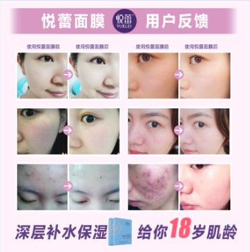 悦蕾抗皱补水面膜,悦蕾面膜美白淡斑效果