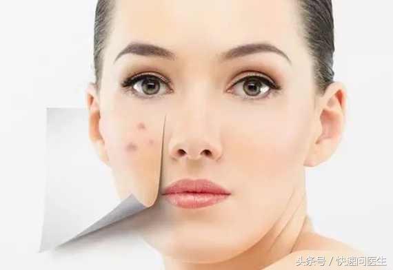 鼻翼两边的脸颊长痘痘什么原因,一上火鼻翼两侧就长痘是什么原因