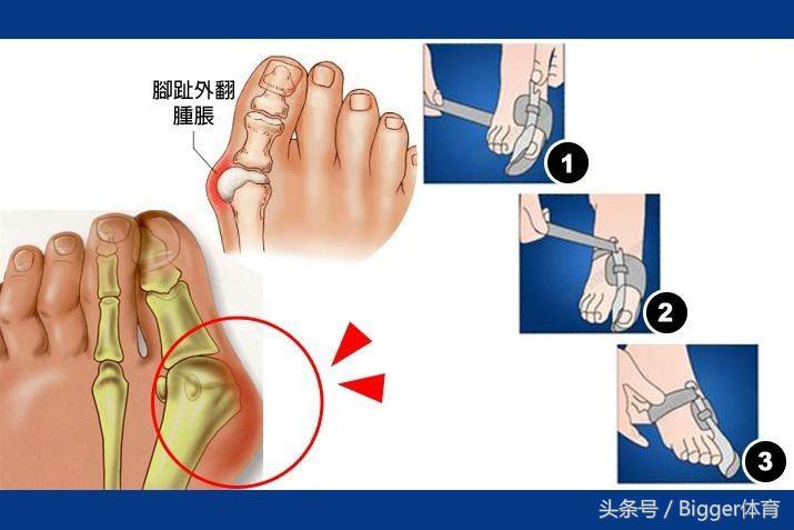 璺戝弸璁板綍绮惧僵鐗囨,璺戝弸绮惧僵鐬棿