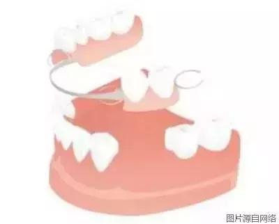 掉牙时强行拔牙弄下来会发生什么,拔牙以后真的会牙齿掉得快吗