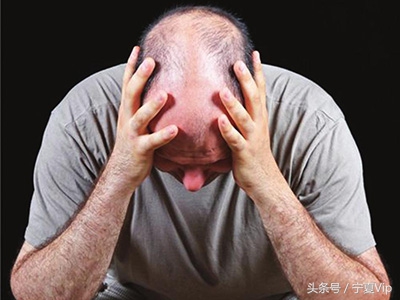 加班脱发,熬夜加班导致的脱发能恢复吗