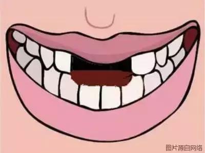 掉牙时强行拔牙弄下来会发生什么,拔牙以后真的会牙齿掉得快吗