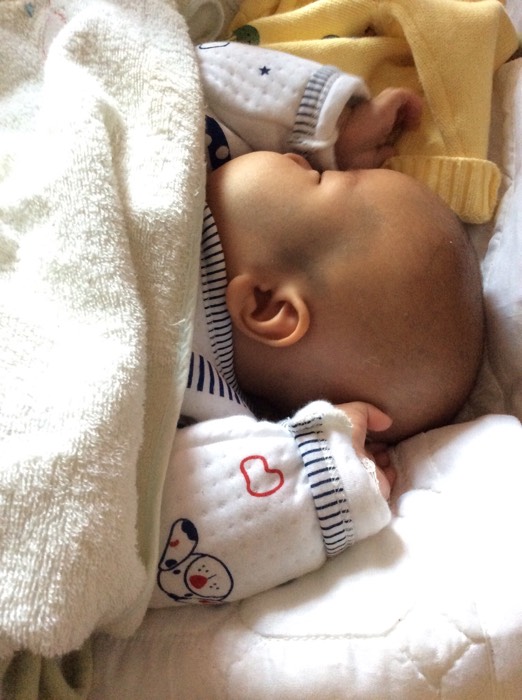 丢失孩子出生时脖子后面有胎记,婴儿出生胎记用不用去除