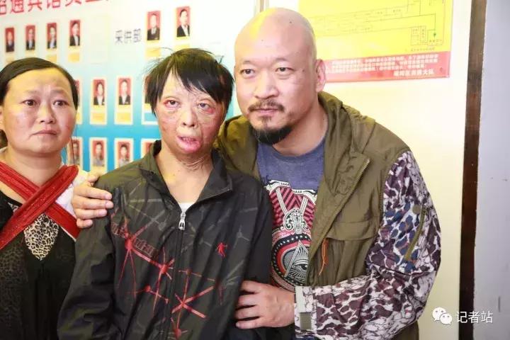 硬汉斌子：读懂创伤疤痕下的儿童