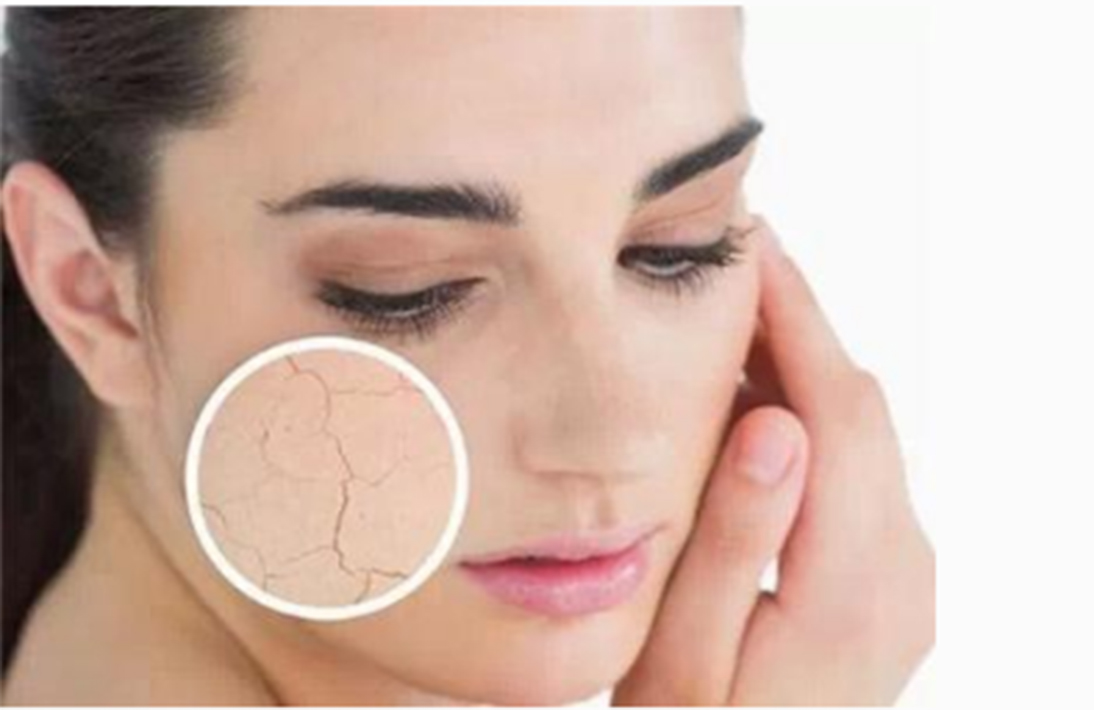 秋冬季节怎么防干燥,秋冬季节怎样保湿