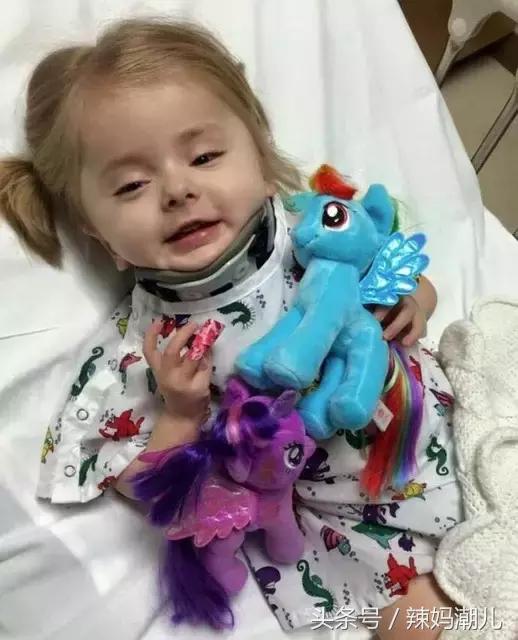 大排畸过时间了就不能做了吗,大排畸没问题还需要担心吗