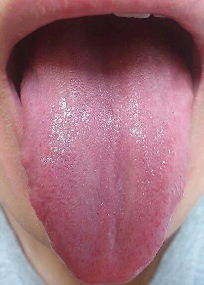 做艾灸喝红糖水好吗,用生姜和红糖怎么做艾灸