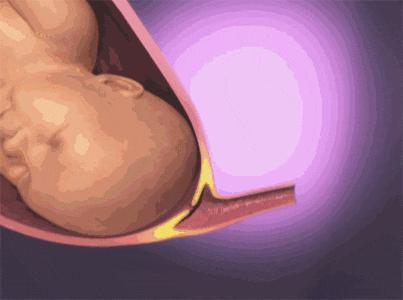 分娩过程简述20字,分娩的全部过程了解