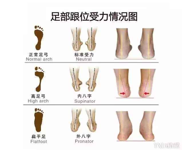 崴过脚以后你的脚还是疼怎么办,崴过的脚恢复好后总疼