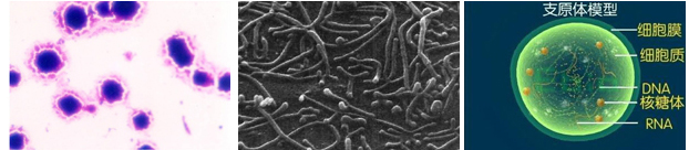 肺炎支原体感染治疗,支原体感染的治疗用左氧有效果吗