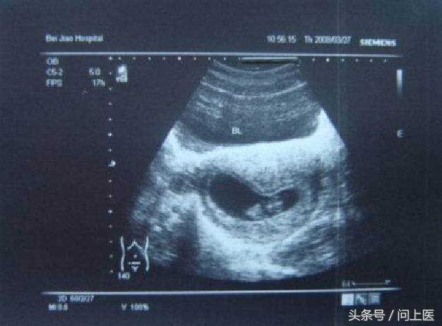 生男生女的谣言有哪些,到底生男生女要不要听谣言