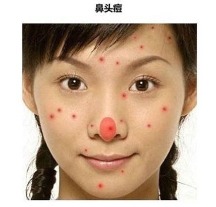 长痘真的影响颜值教你祛痘小妙招,祛痘小知识如何正确避免长痘