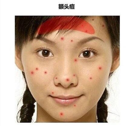 长痘真的影响颜值教你祛痘小妙招,祛痘小知识如何正确避免长痘