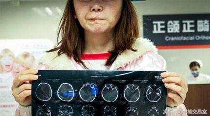 韩国割双眼皮要多少钱人民币,韩国割双眼皮多少钱人民币