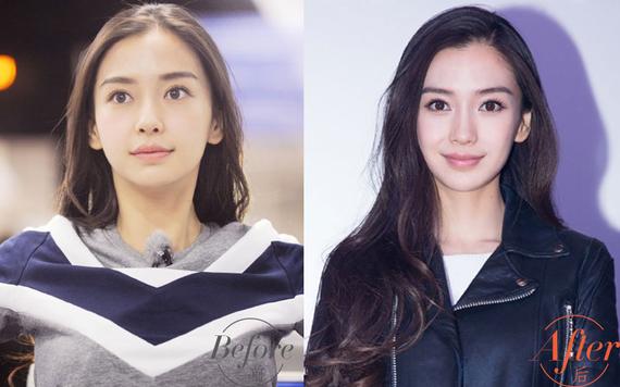 鼻子塌怎么变挺明星,塌鼻子明星都有哪些