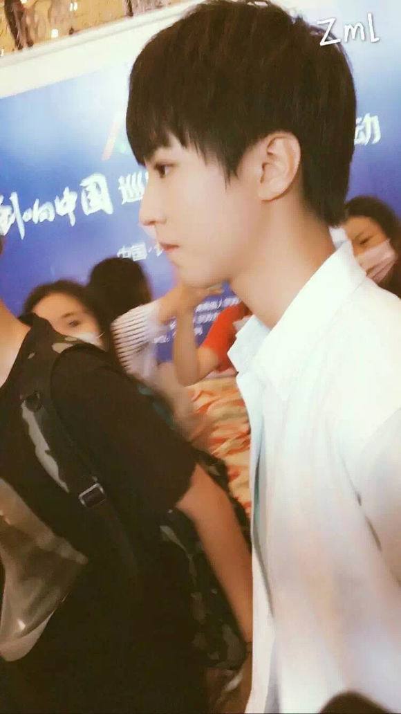 杨颖整牙前和整牙后的区别,baby杨颖整牙