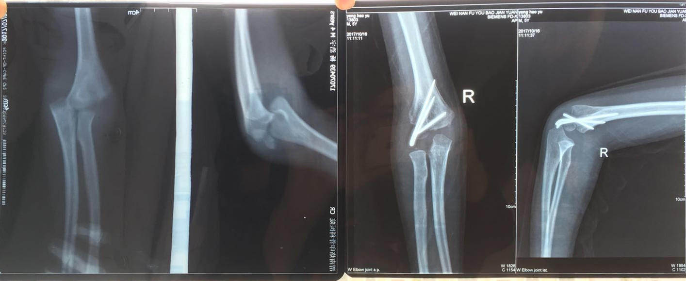 渭南妇幼保健院骨科医生,渭南市儿童妇幼保健院