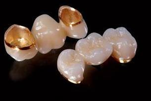 如何科学地选择烤瓷牙种类,护牙健齿的三大秘诀