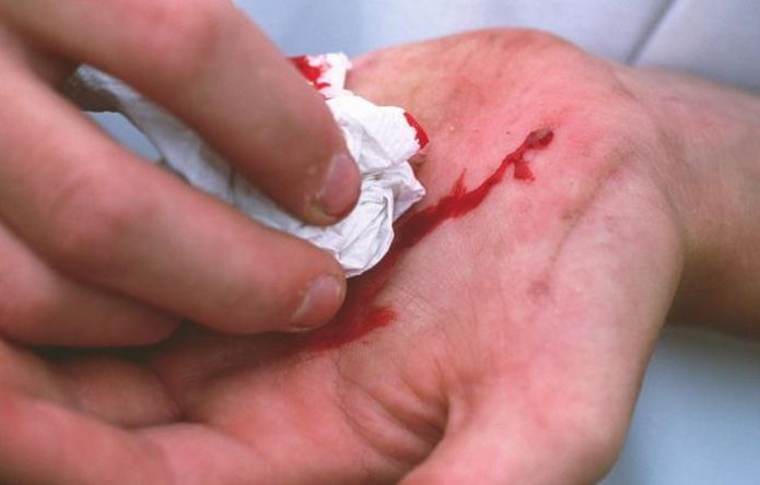 43岁女子剖腹产生二胎，产后不听医生建议，20天后伤口发臭流脓水