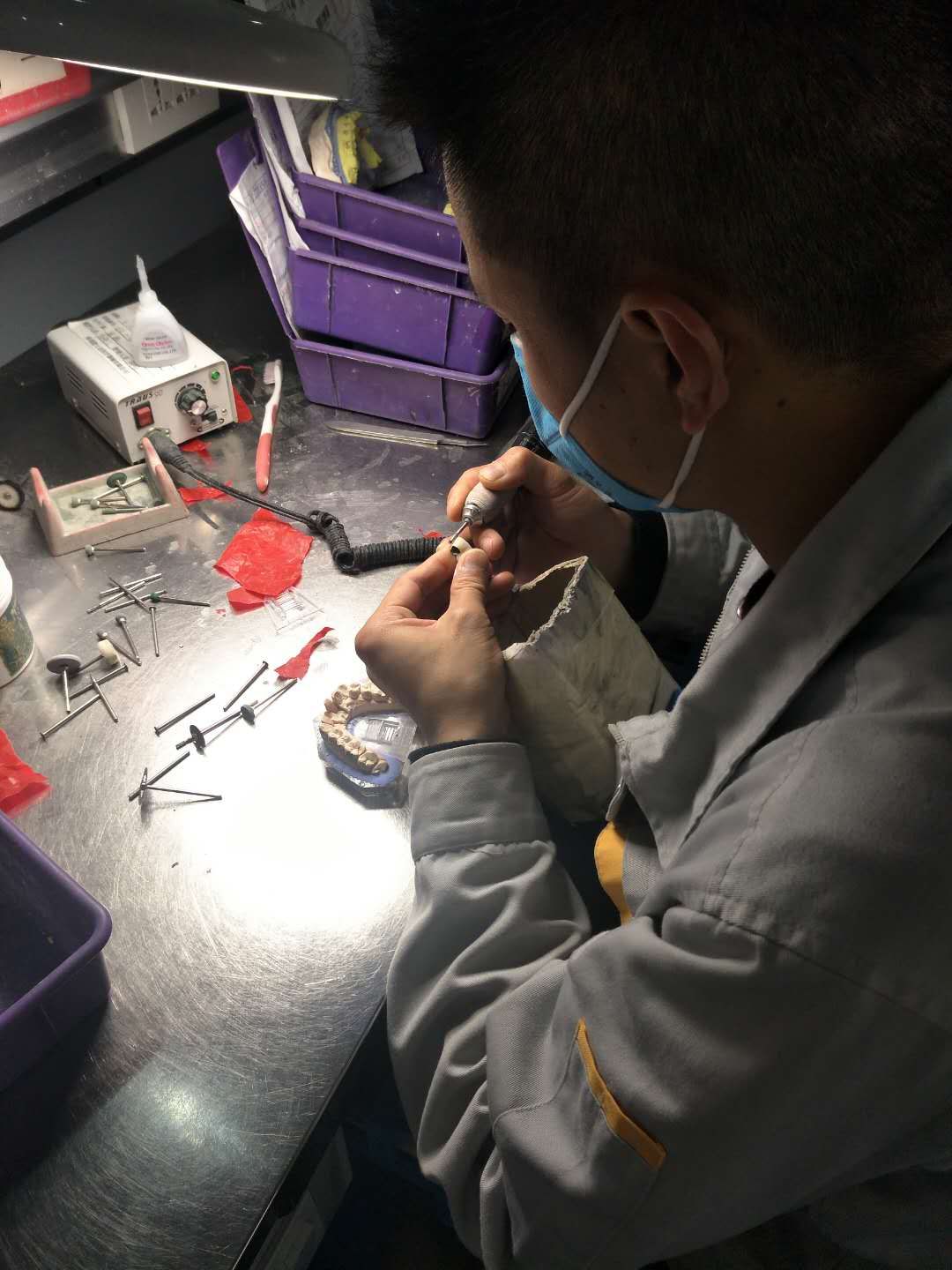 烤瓷牙齿步骤,烤瓷牙齿的做法大全