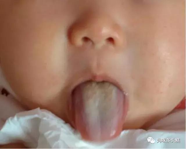 黄帝内经如何治疗眼袋,宝宝有黑眼圈没有食欲