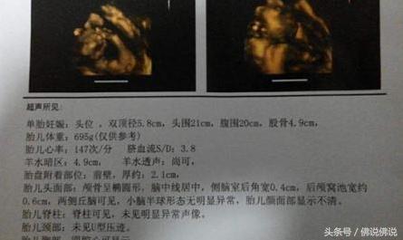 做四维彩超有什么注意事项,做四维彩超的注意事项是什么