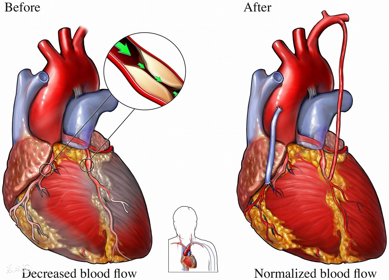 核桃油真的有网上说的那么好吗,核桃油到底有没有必要