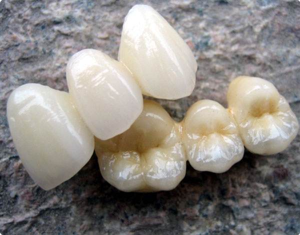 烤瓷牙齿步骤,烤瓷牙齿的做法大全