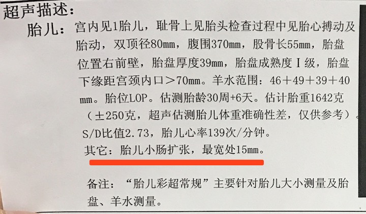 孕期小肠扩张宝妈经验分享,孕期肠管扩张14mm严重吗