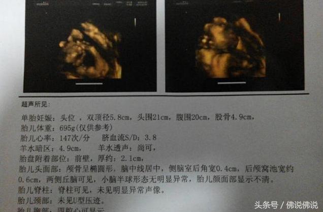 做四维彩超有什么注意事项,做四维彩超的注意事项是什么