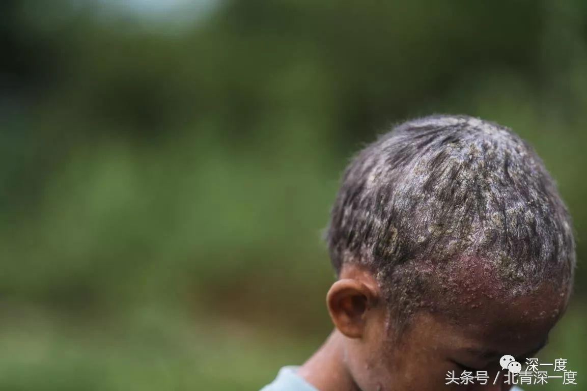 「看见」泥坑里的“鹿晗”和吃土豆的孩子：80张图，读懂中国脱贫