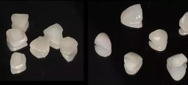 牙齿被判了死刑，就真的没救了