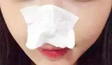 只需20块钱就能去黑头,平价去黑头神器