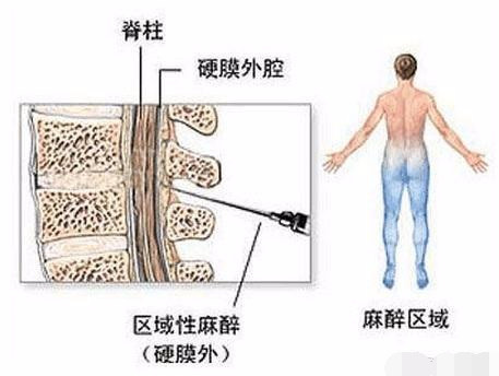 剖腹产手术全过程图解，需要切开7层才能将宝宝取出