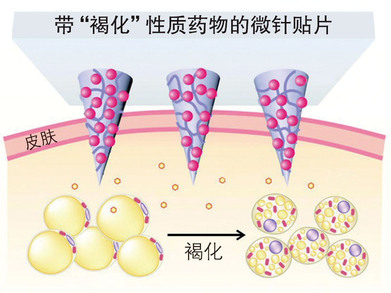 减肥神器全身贴,减肥神器懒人按摩贴