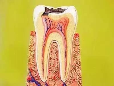 牙齿被判了死刑，就真的没救了