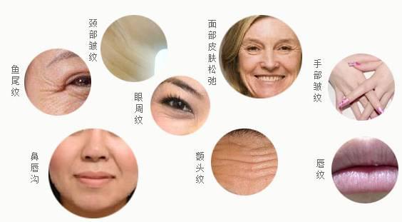 超声刀多久做一次？超声刀做完会反弹吗？