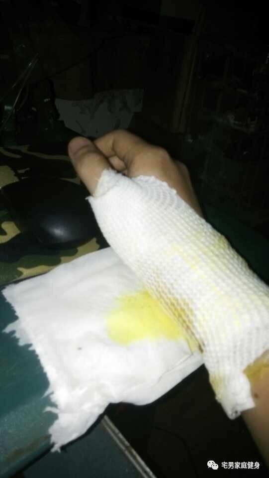 健身手腕怎么快速恢复,健身手腕受伤了怎么康复训练