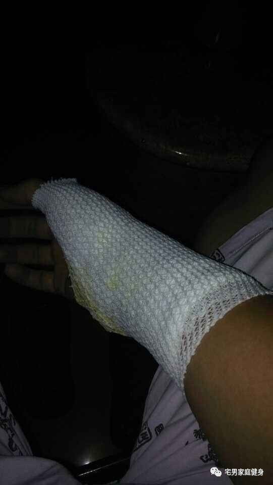 健身手腕怎么快速恢复,健身手腕受伤了怎么康复训练