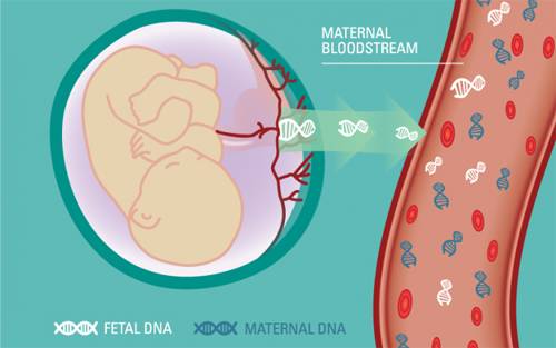 最新唐氏综合征临床研究情况,唐氏综合征最新视频