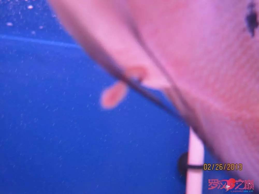 慢性肠炎的症状表现及治疗方法,慢性肠炎用中医还是西医治疗好