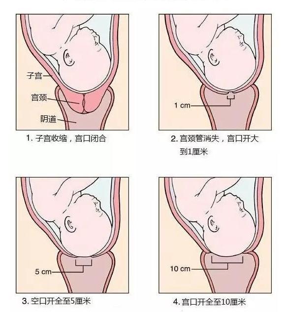 十月怀胎一朝分娩骨开十指,孕妇开十指是什么意思