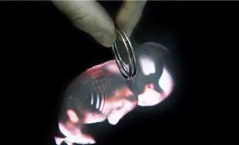 上环有十几年了不取对身体有害吗,上环一个月了还出血对身体有害吗